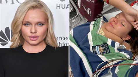 alli simpson|alli simpson accident.